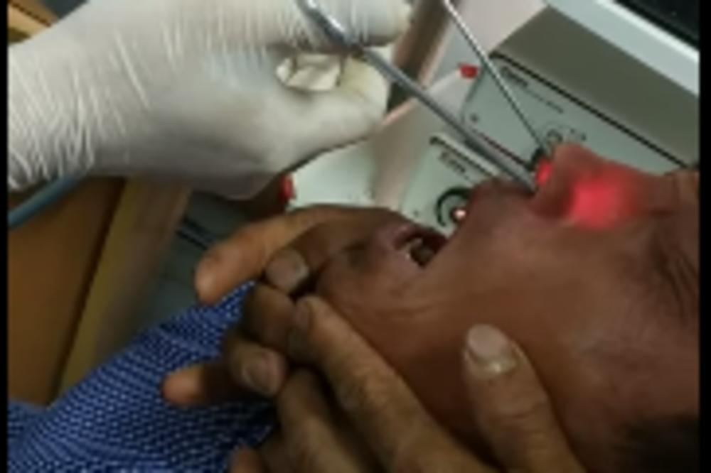 IZ NOSA MU IZVADILI PARAZITA KOJI JE TU BORAVIO 2 MESECA! Pacijent ostao u čudu, lekari još više! (VIDEO)