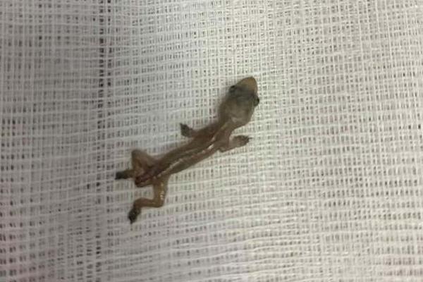 ŽALILA SE NA BOL U GLAVI: Otišla je kod lekara i ZAPREPASTILA SE kada je čula DA OVO ŽIVI U NJOJ! (FOTO)