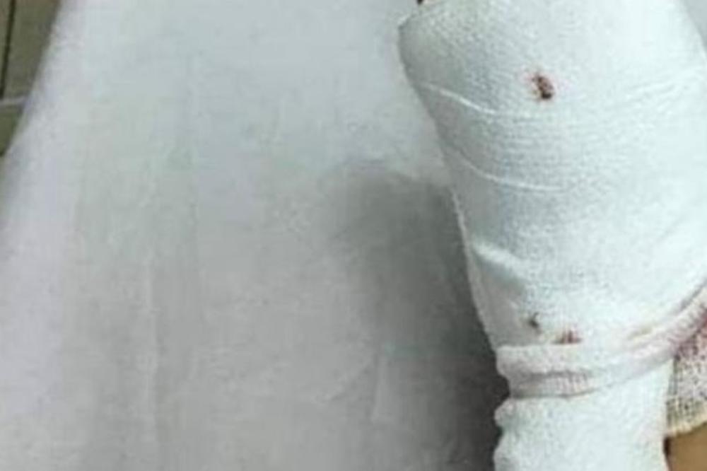 OBULA JE ČARAPE DA ZAVEDE MUŽA, A ON JOJ POLOMIO NOGE PALICOM: Pre OSUDE, pogledajte ČARAPE! (FOTO)