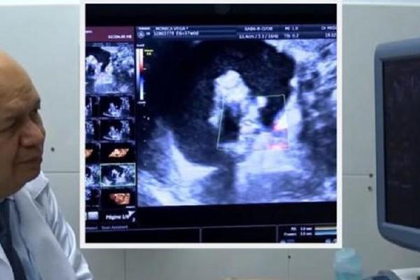 KADA JE LEKAR NA URGENTNOM VIDEO OVO NA ULTRA ZVUKU PAO JE U NESVEST! Ovo niko nije očekivao, svi su u ČUDU (VIDEO)