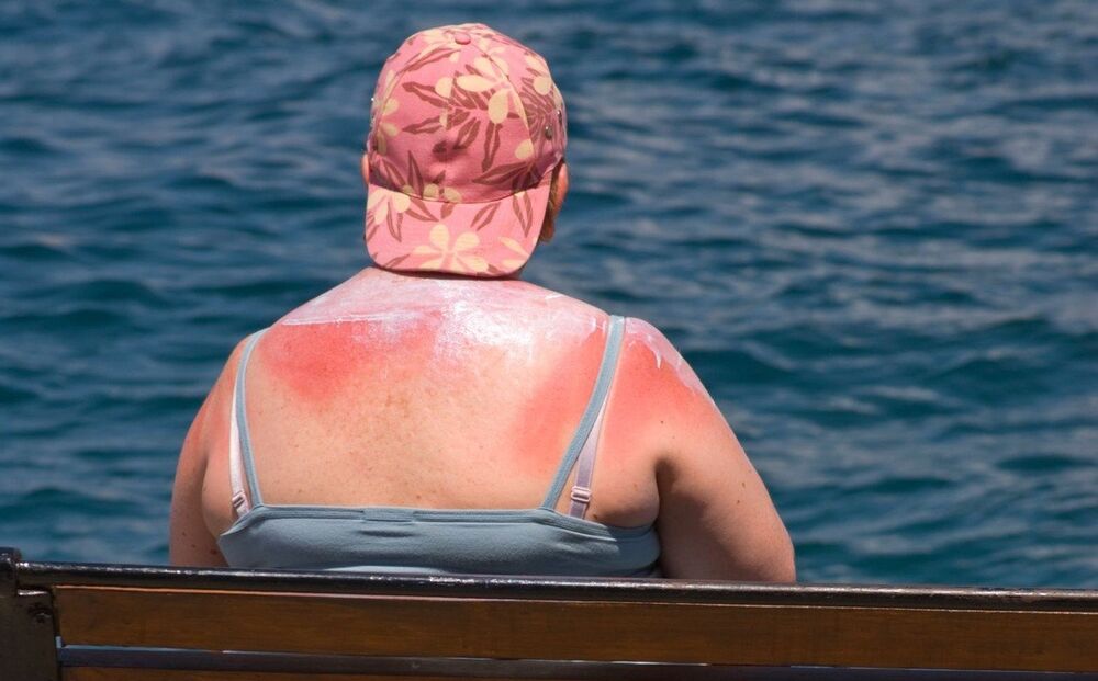 Kada ovoliko pocrvenite već je kasno, ali ima spasa!