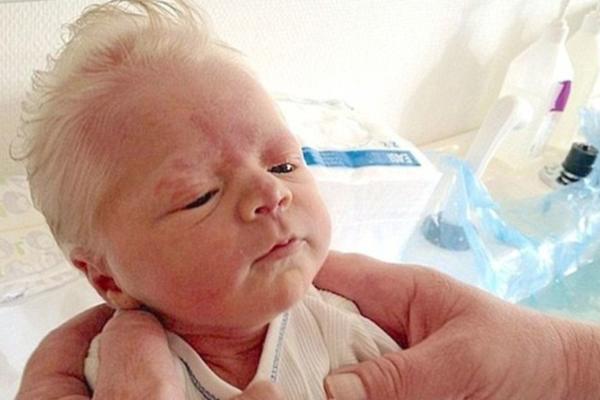 BEBA ROĐENA SA SEDOM KOSOM: Doktori ne znaju gde da svrstaju ovaj fenomen! (FOTO)