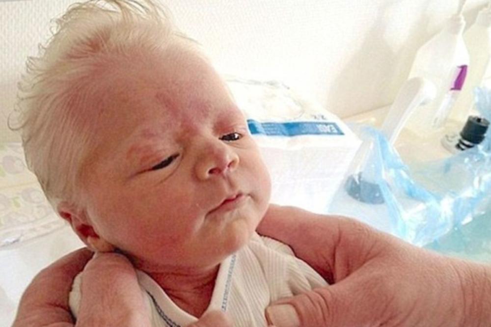 BEBA ROĐENA SA SEDOM KOSOM: Doktori ne znaju gde da svrstaju ovaj fenomen! (FOTO)