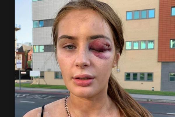 STUDENTKINJU PRETUKAO MANIJAK DOK SE VRAĆALA IZ KLUBA: Rekla mu je samo JEDNU REČENICU, a onda ju je KRVNIČKI NAPAO