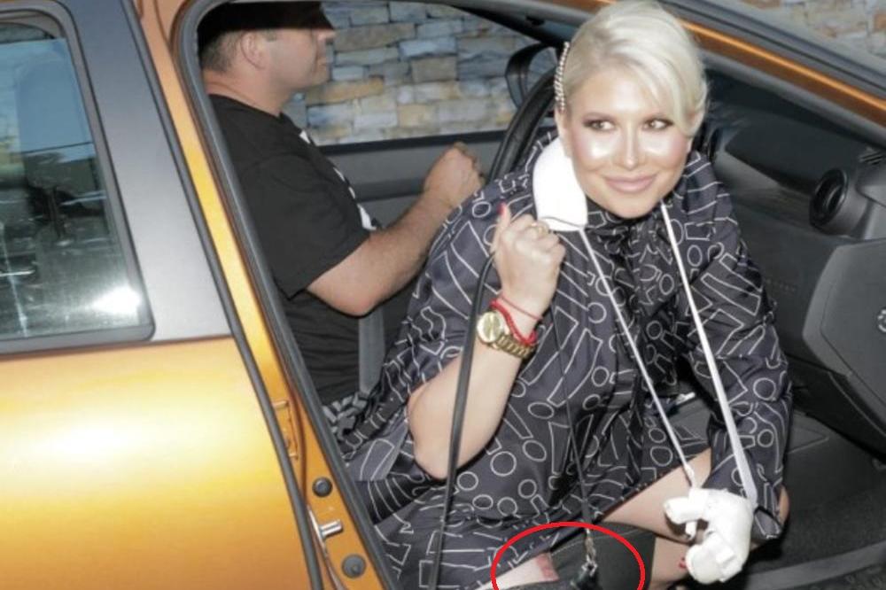 SVI SU VIDELI VELIKU CRVENU FLEKU NA DEINOJ DESNOJ NOZI: Otkrivamo kako je ona nastala, ovo će vam SLOMITI SRCE