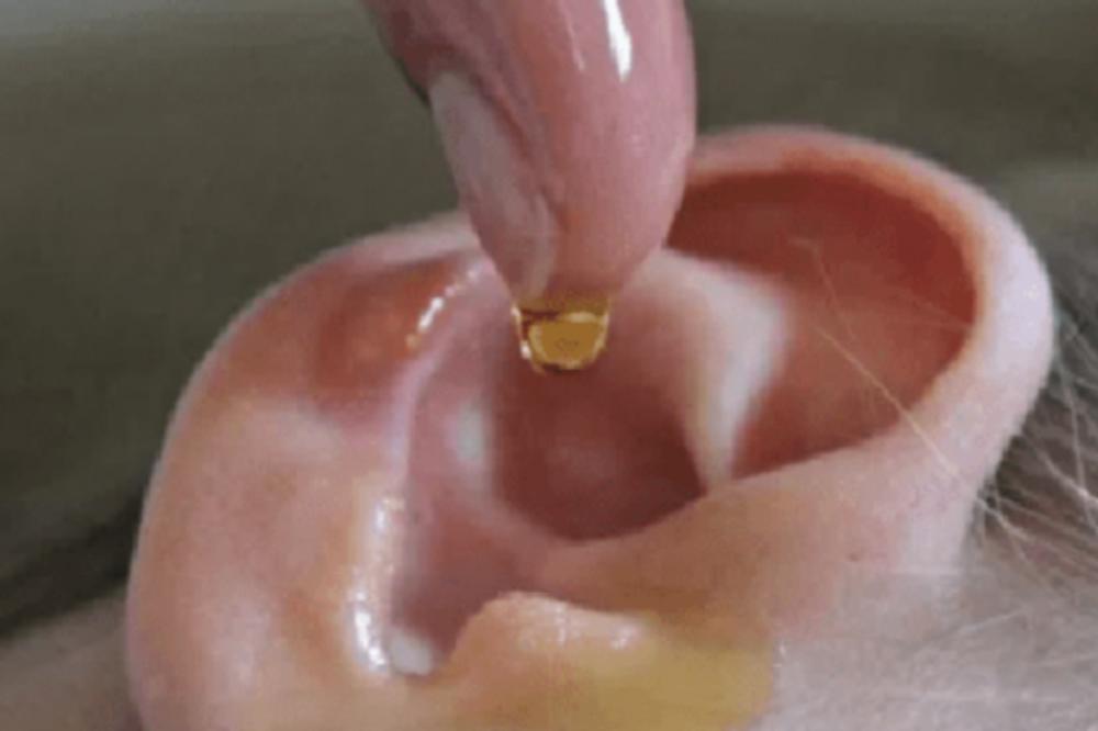 NI SLUČAJNO NE KORISTITE ŠTAPIĆ: Doktor otkrio genijalan način kako da IZBACITE SAV VOSAK IZ UŠIJU!