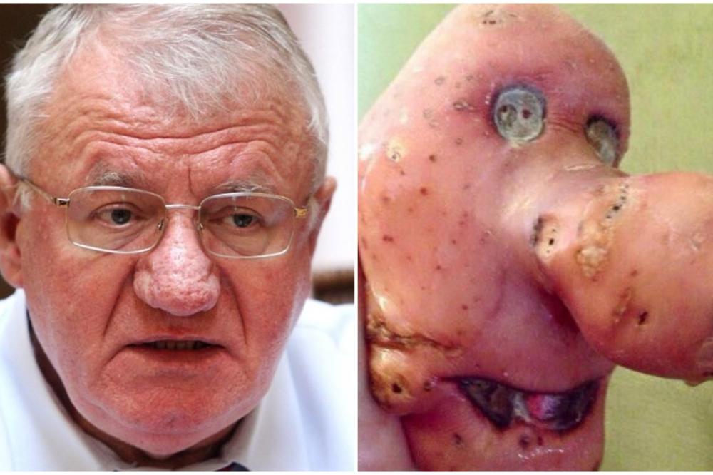 ZNAM DA GO*NARI NEĆE BITI ZADOVOLJNI JER NISAM LJUT! Šešelja su uporedili s RUŽNIM KROMPIROM! SADA ON IMA PORUKU!