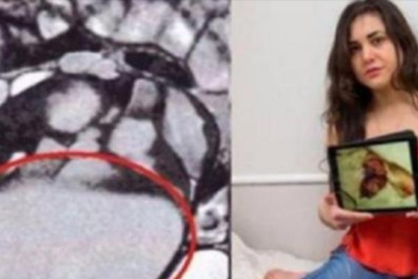 Dok je vodila ljubav sa momkom osetila je kako nešto mrda u njoj! LEKAR JE IZVADIO STRAŠNU STVAR IZ NJE!