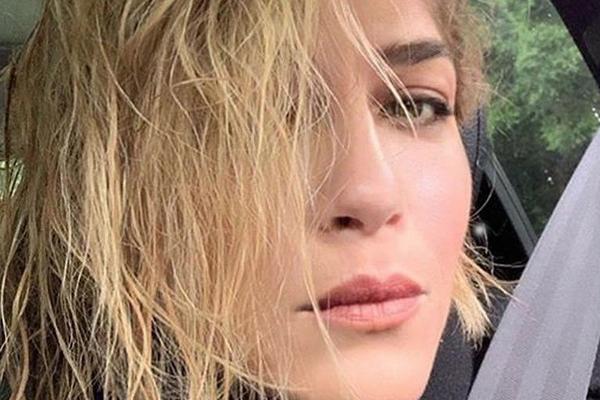 SLAVNA GLUMICA SE BORI ZA ŽIVOT: Ono što joj se desilo je UŽASNO! (FOTO)