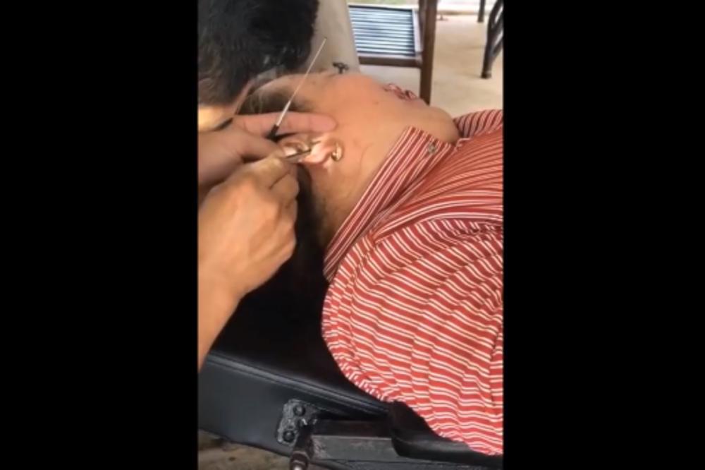 ŽALILA SE NA BOL U GRLU, PA JE OTIŠLA KOD LEKARA! Ono što je usledilo je JEZIVO, izvukao je iz nje OVO! (FOTO)