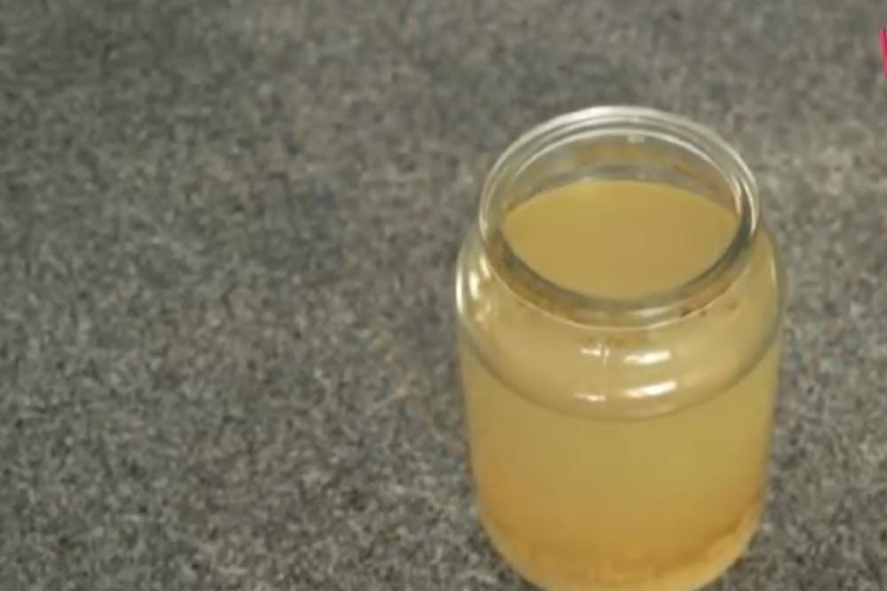 STAVLJALA SAM RUKU U MEŠAVINU VODE I SIRĆETA 3 PUTA NEDELJNO: Evo šta mi se DESILO