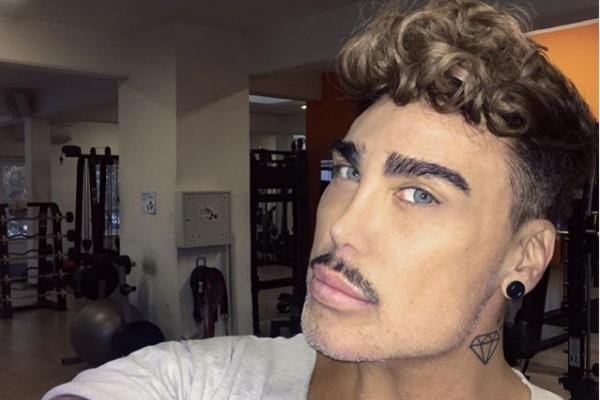 BIO JE U VELIKOM BRATU, FARMI I PAROVIMA: Imao je problem s EREKCIJOM, izoperisao se i sad liči NA LUTKU! (FOTO)