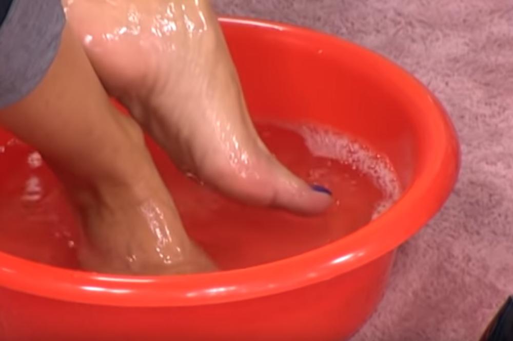 UKOLIKO VAM NOGE OTIČU TOKOM LETA! Glavni krivac za to se nalazi u vašoj KUHINJI!