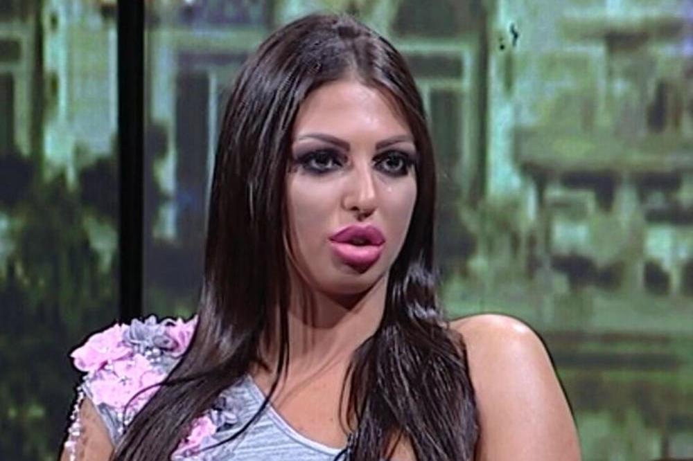 MAJA MARINKOVIĆ ODRADILA JOŠ JEDNU ESTETSKU INTERVENCIJU! Nezadovoljna svojim izgledom posle BRUKE sa Janjušem