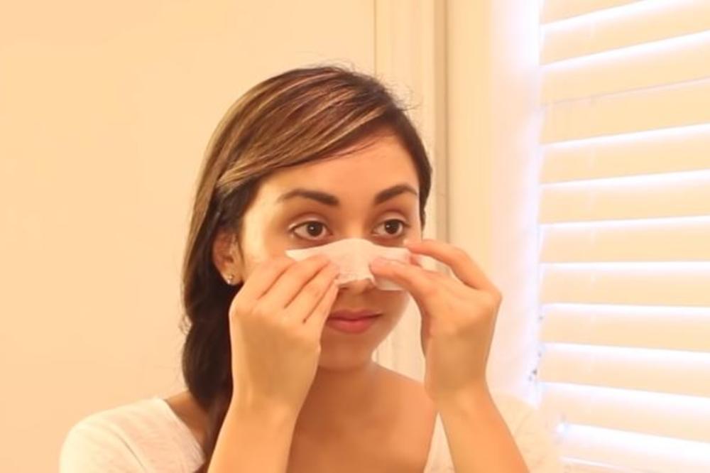 REŠITE SE MITISERA NA NOSU U SAMO TRI KORAKA: Sve što vam je potrebno već imate u kući! (VIDEO)