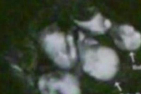 U DRUGOM STANJU JE BILA 10 MESECI, A BEBA NIJE IZLAZILA! Otišla je kod lekara, a onda se desilo nešto ODVRATNO