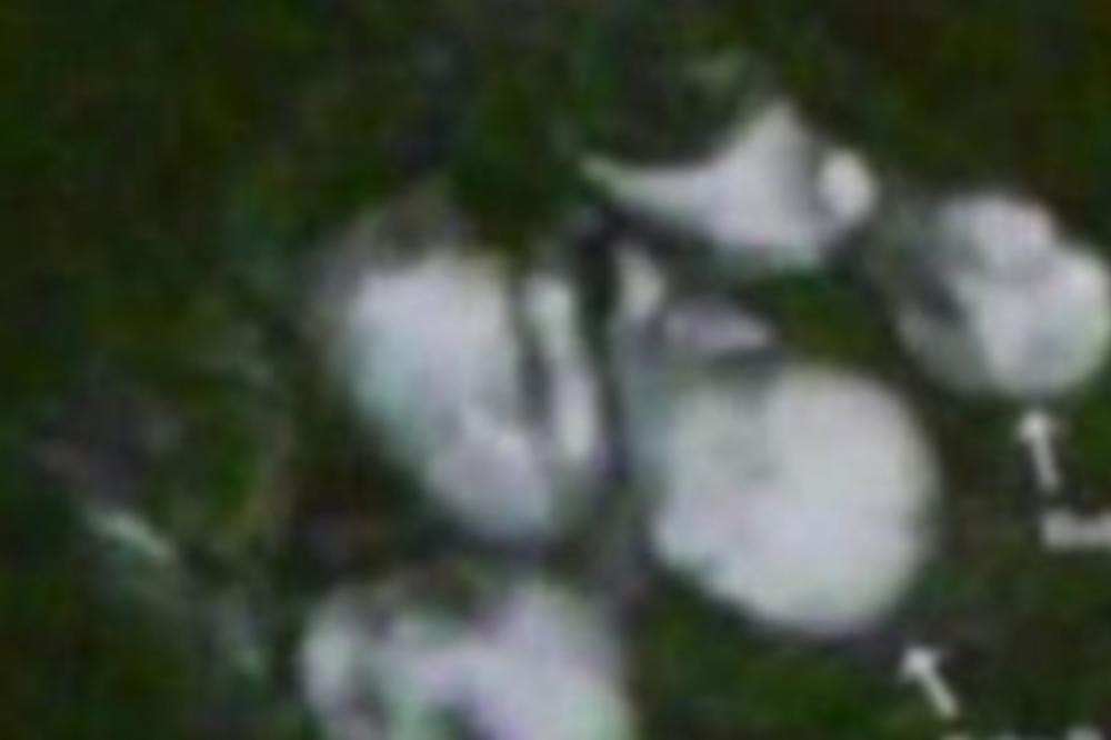 U DRUGOM STANJU JE BILA 10 MESECI, A BEBA NIJE IZLAZILA! Otišla je kod lekara, a onda se desilo nešto ODVRATNO