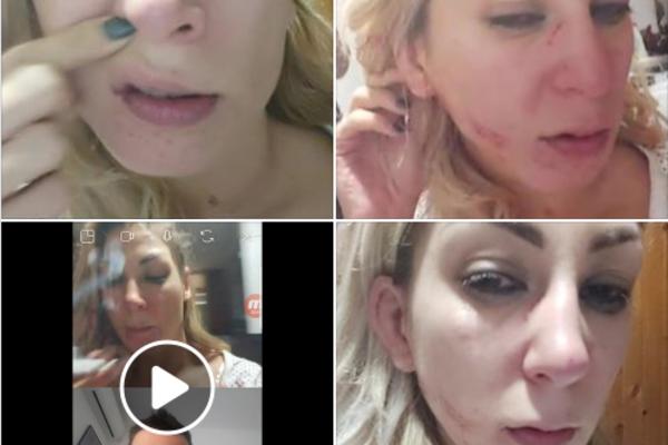 POTRESAN SNIMAK PRETUČENE NADEŽDE: Nakon BATINA odmah je pozvala NJEGA! (VIDEO)