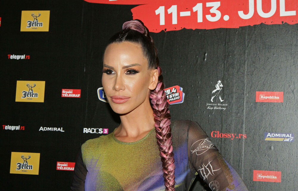 Nikolija progovorila o estetskim zahvatima