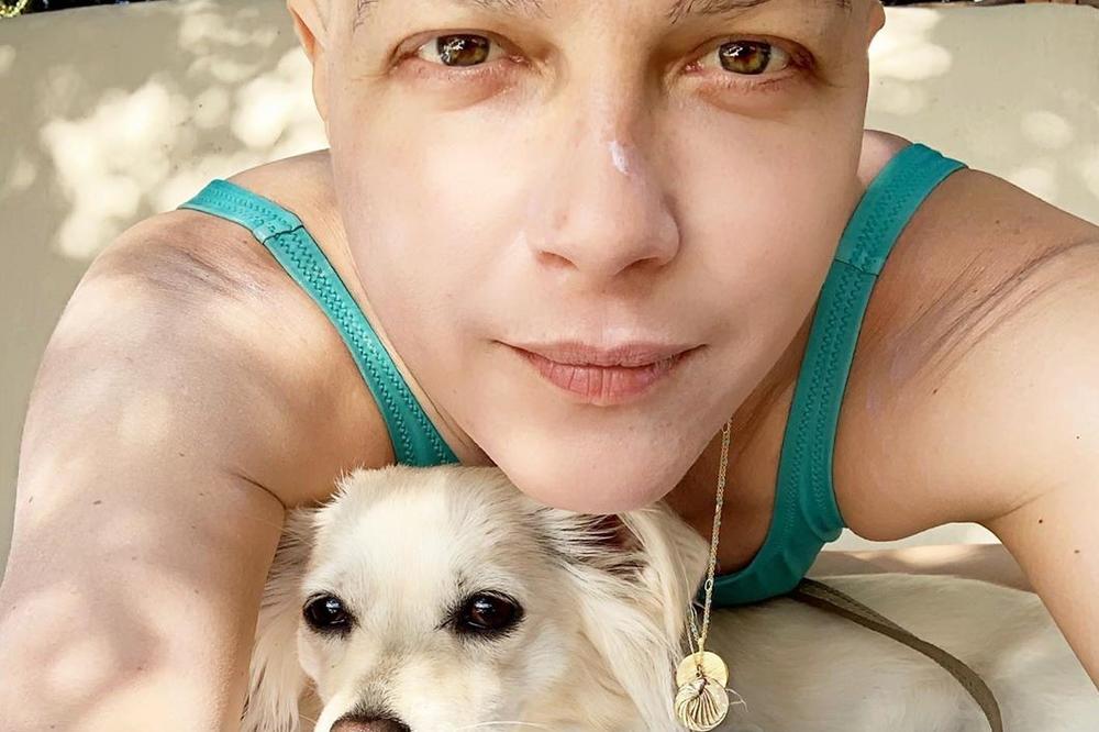 ČUVENA GLUMICA BIJE NAJTEŽU BITKU! Zadesila je TEŠKA BOLEST! Ono što je otkrila o hemoterapijama je mnoge potreslo