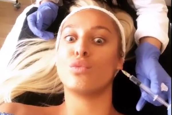 LUNA PROGOVORILA O ESTETSKOJ KOREKCIJI O KOJOJ SVI PRIČAJU: Morala sam, lice mi je BILO MRTVO posle dve godine!