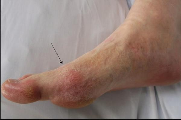 OVO SU ZNAKOVI DA VAM ŠEĆER RAZARA ORGANIZAM! Ne ignorišite ih, POSLEDNJI JE KOBAN!