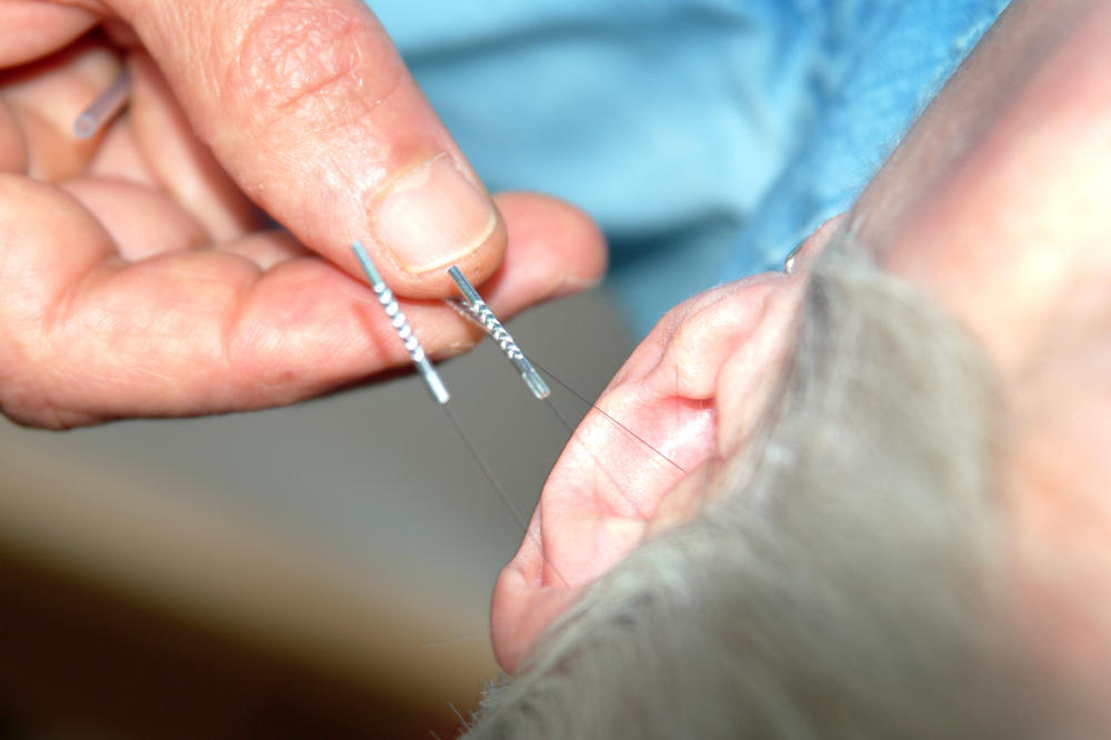 PRITISNITE OVE TAČKE NA TELU I BOL ĆE ODMAH NESTATI: Kineska metoda koja se koristi godinama