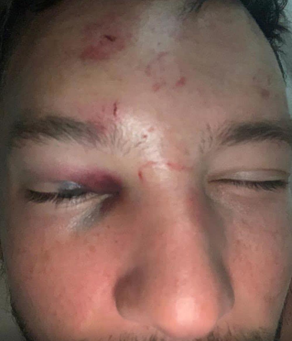 Unakaženi Deni Drinkvoter  