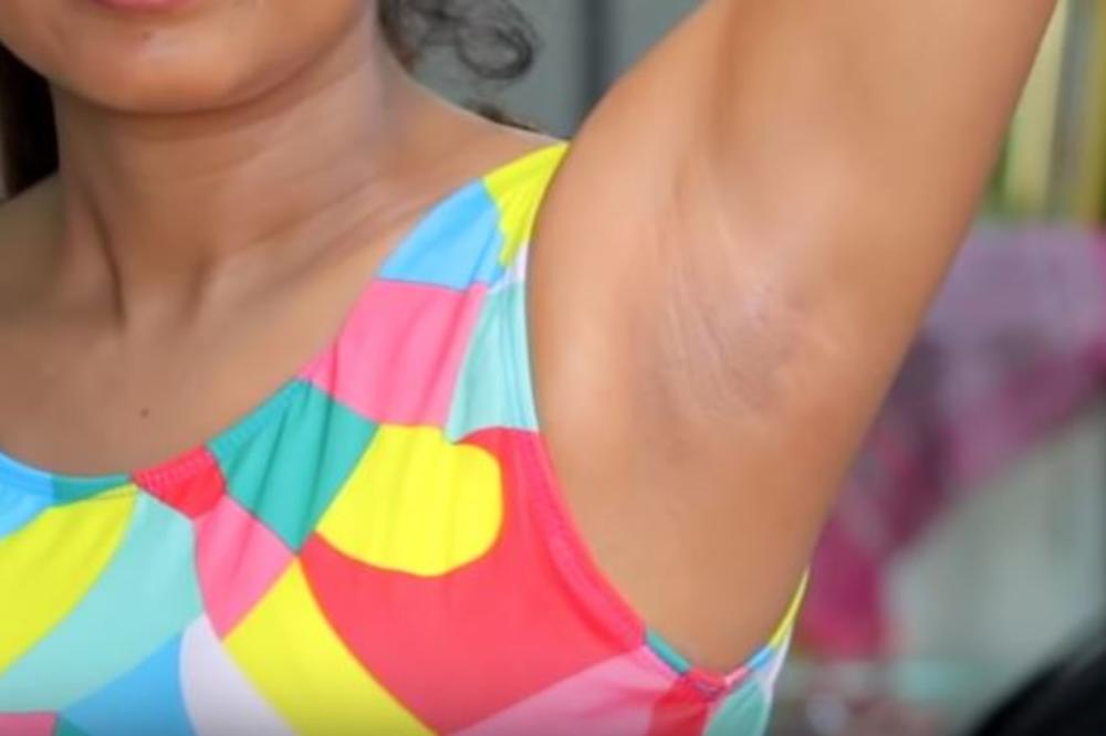 MUČE VAS TAMNE MRLJE ISPOD PAZUHA? Potrebna vam je samo jedna namirnica I ONE ĆE ZAUVEK NESTATI!