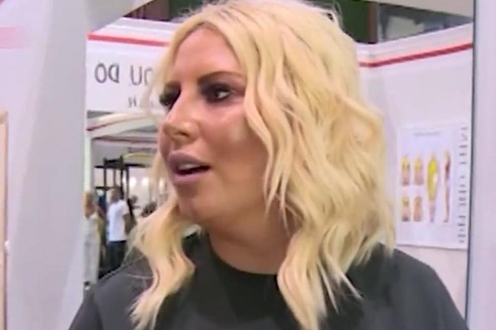 MISLILI SMO DA JE DEI RUKA U NAJGOREM STANJU - A, onda se SKINULA pa pokazala NOGU - SVI se ZAPREPASTILI! (FOTO)