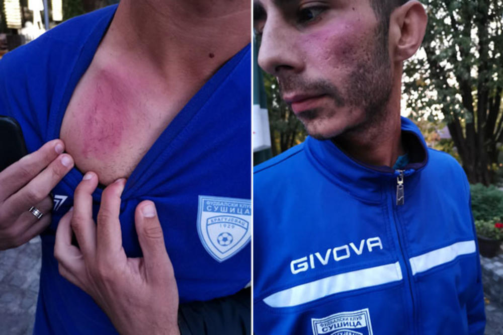 FUDBALERI PRETUČENI U VALJEVU! Huligani upali u svlačionicu gostiju i razbijali sve redom!