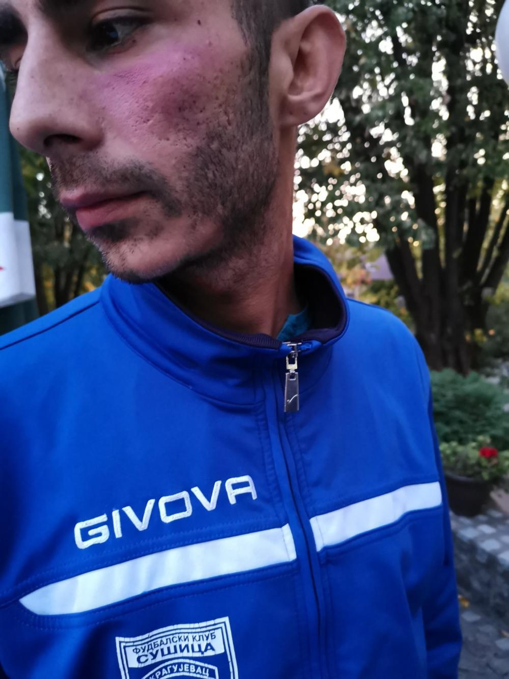 Fudbaler Sušice pokazuje modrice