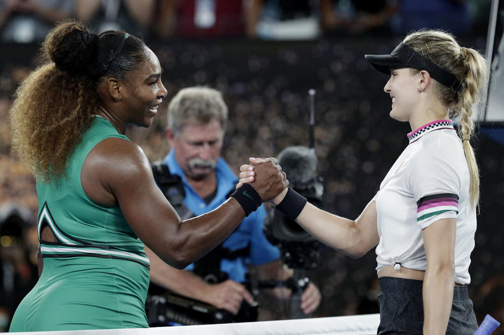 MISLIM DA MI SE OD KOKICA POVEĆALA GUZA: Teniserka doživela promenu - pogledajte pa sami procenite da li je u pravu