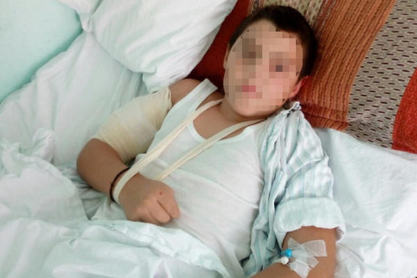 OVO JE DEČAK KOGA JE AKITA NAPALA! Kidala mu je RUKE, spasila ga je 1 STVAR!