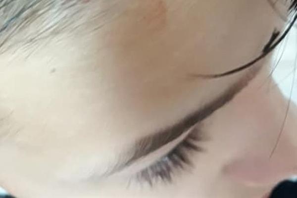 DEČAKU RASEČENA GLAVA OD UDRACA O STO! Stravično VRŠNJAČKO NASILJE u Osnovnoj školi u Odžacima! (FOTO)