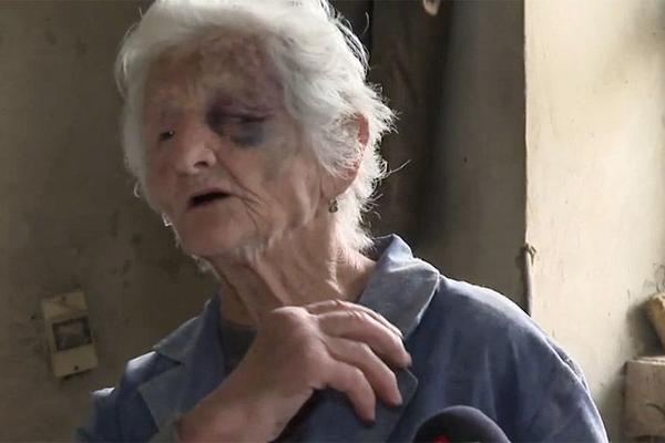 DOK SU ME BATINALI, OSEĆALA SAM DA ĆU UMRETI! Mučenu baku iz Subotice KRVNIČKI TUKLI ZBOG 3.000 DINARA! (FOTO)