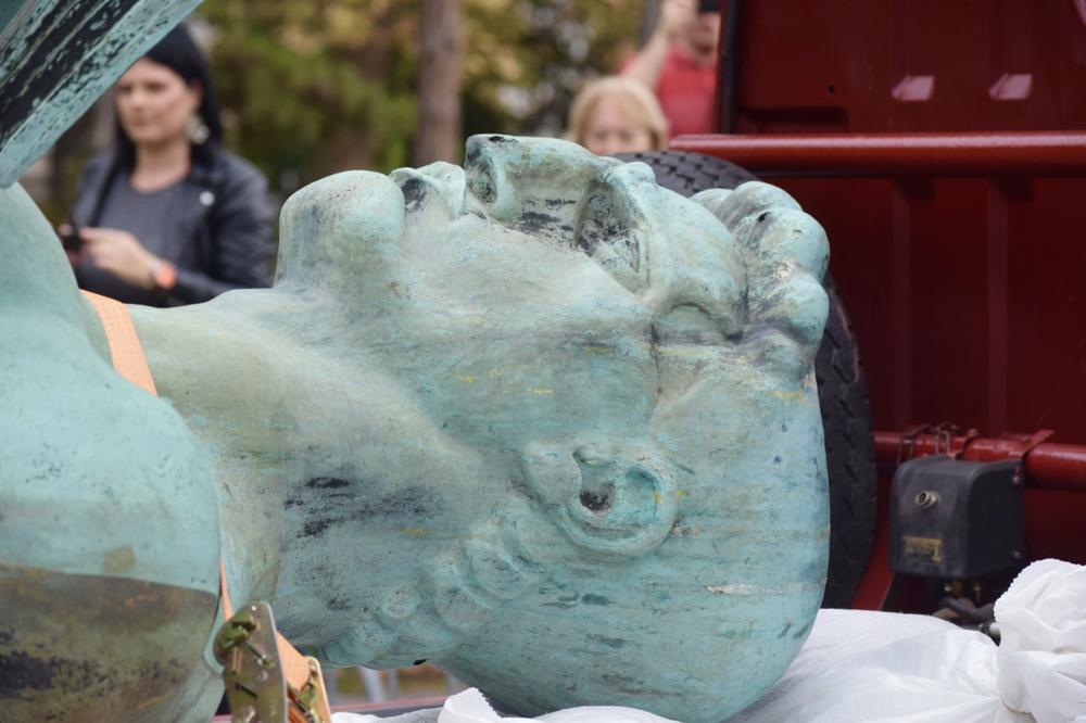 ISPEGLALI SU MU JAGODICE, U USNE STAVILI SILIKONE! Pobednik je dobio FEJSLIFTING, komentari su HIT!