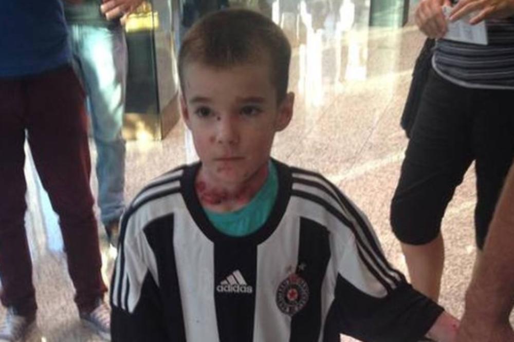 PREMINUO MALENI DESPOT LAZIĆ: Dečak leptir izgubio životnu bitku!