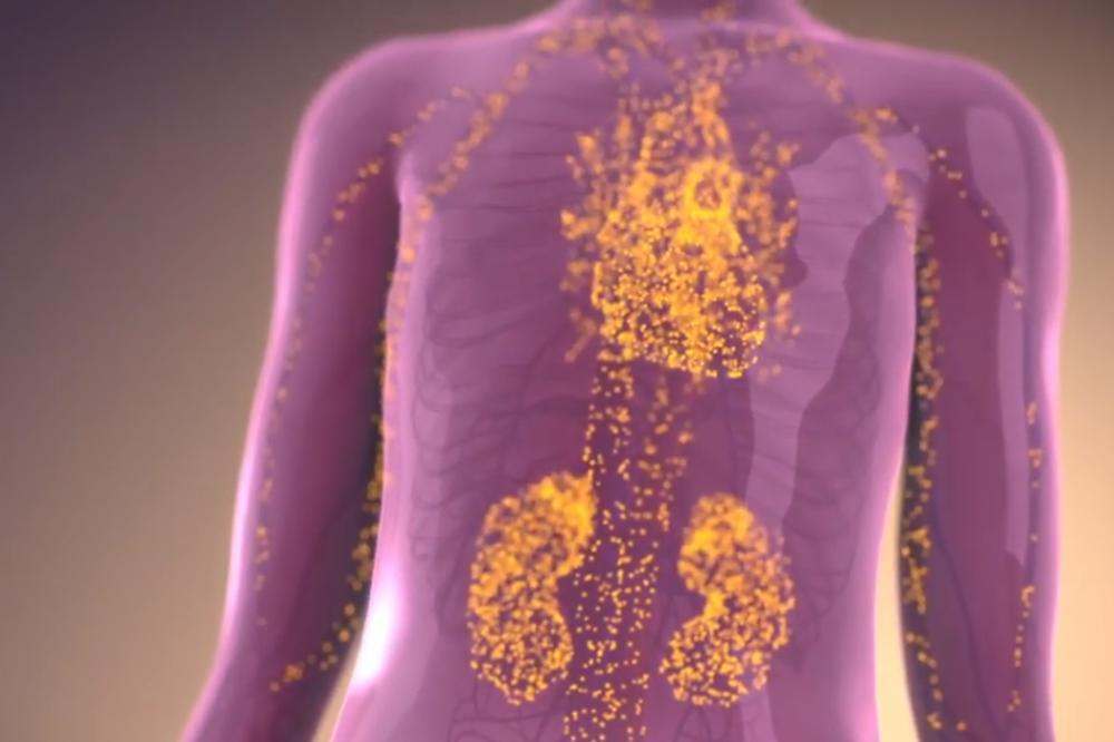 ZA OVU BOLEST SRBI JEDVA DA ZNAJU: Na nju ukazuju trnjenje šaka i vrtoglavica, DO DIJAGNOZE JE PUT DUG 15 GODINA