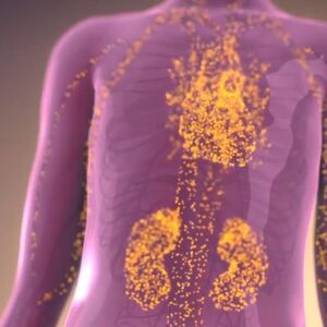 ZA OVU BOLEST SRBI JEDVA DA ZNAJU: Na nju ukazuju trnjenje šaka i vrtoglavica, DO DIJAGNOZE JE PUT DUG 15 GODINA