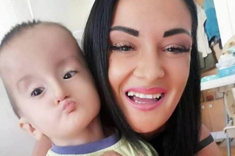 KAD SAM SE PORODILA REKLI: NE GLEDAJTE GA! Ispovest dečaka (4) koji ne može da trepeće i SPAVA OTVORENIH OČIJU