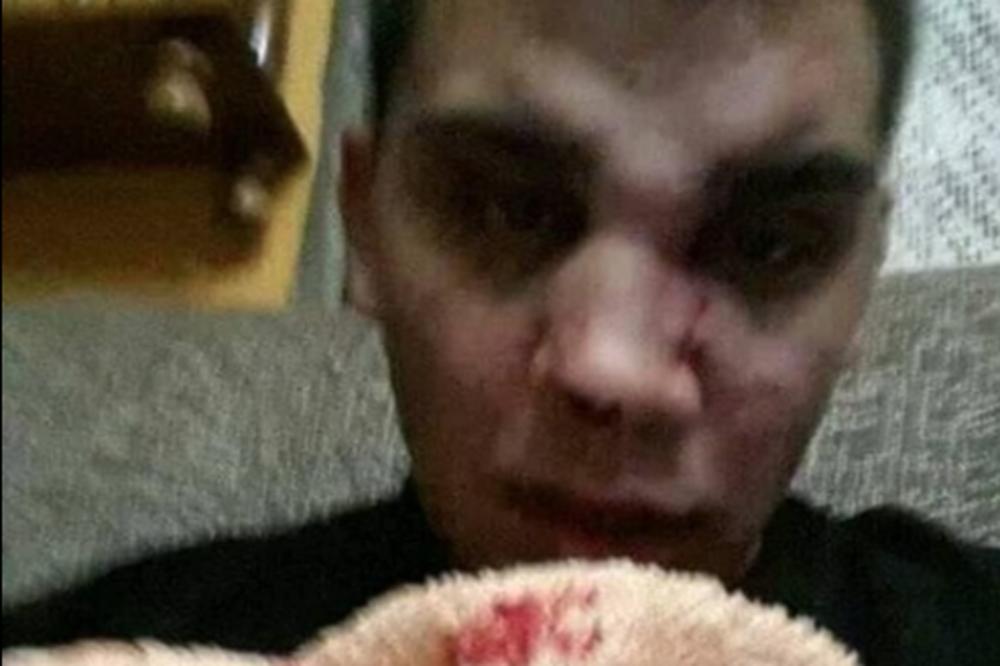 NJIH 15 JE SKOČILO NA MENE, IZLOMILO ME JE OBEZBEĐENJE KLUBA! Nemanja iz Vranja je progovorio o BATINAMA!