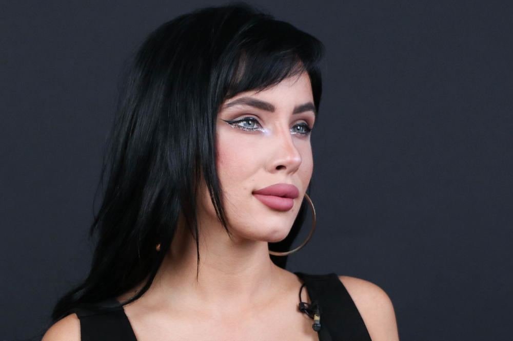 BOŽE GOSPODE, NA ŠTA ONA LIČI?! Pravo lice Aleksandre Subotić OSVANULO NA DRUŠTVENIM MREŽAMA: Sva pod anestezijom!