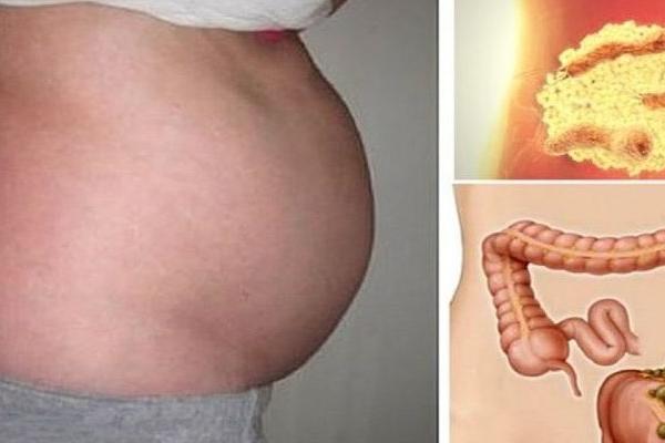 ZVANIČNO PROGLAŠENO! Ovo VOĆE odmah može da otpuši creva, probava će proraditi kao luda nakon što ga pojedete