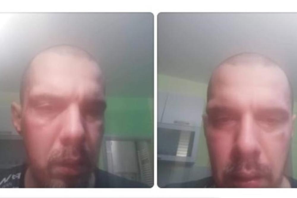 PRVO REKAO DA JE PRETUČEN ZBOG MILA ĐUKANOVIĆA, SAD OPTUŽUJE SINIŠU I VLADIMIRA: Šta mulja Bojan Tomović?!