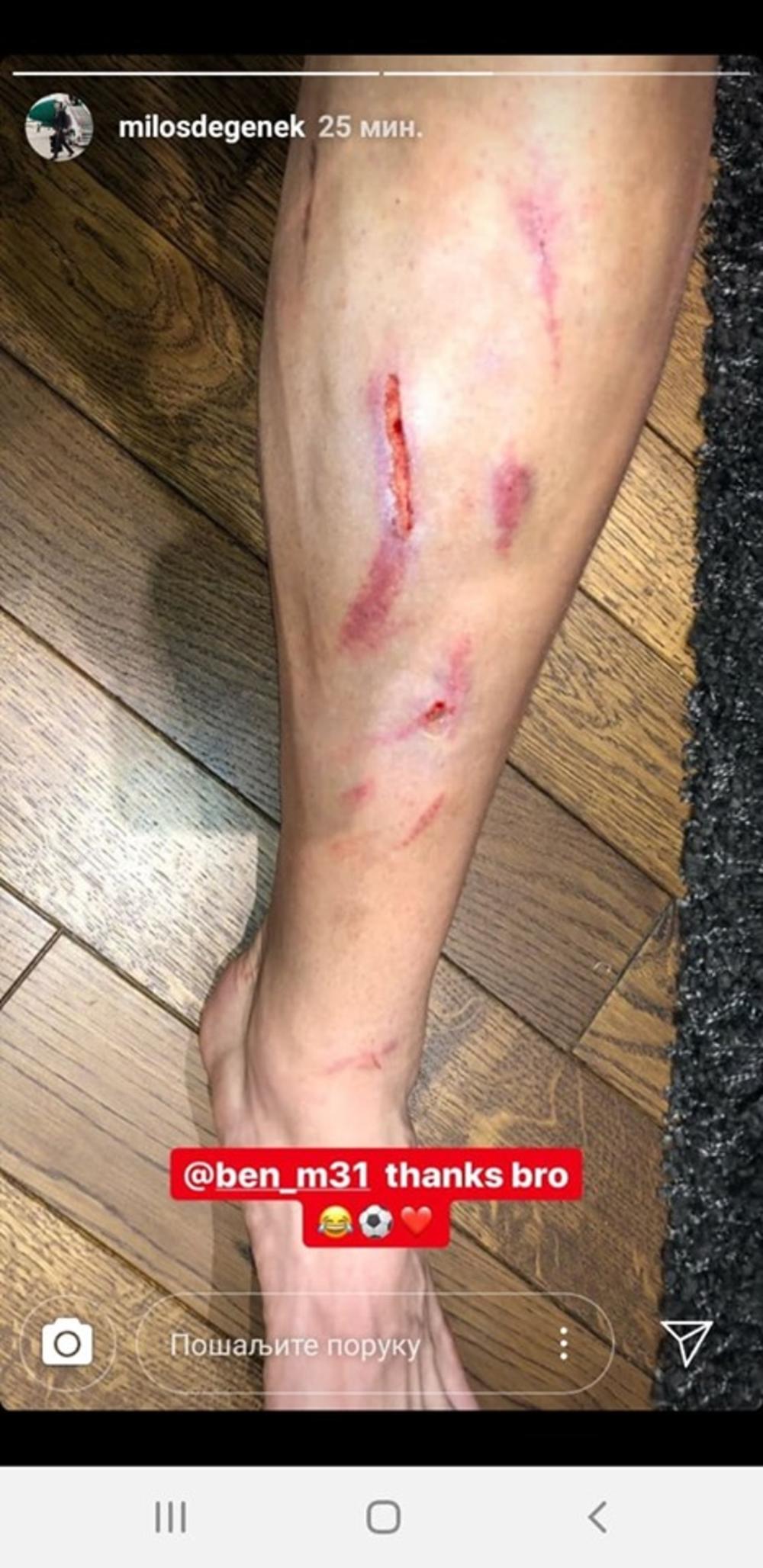 Noga Miloša Degeneka  