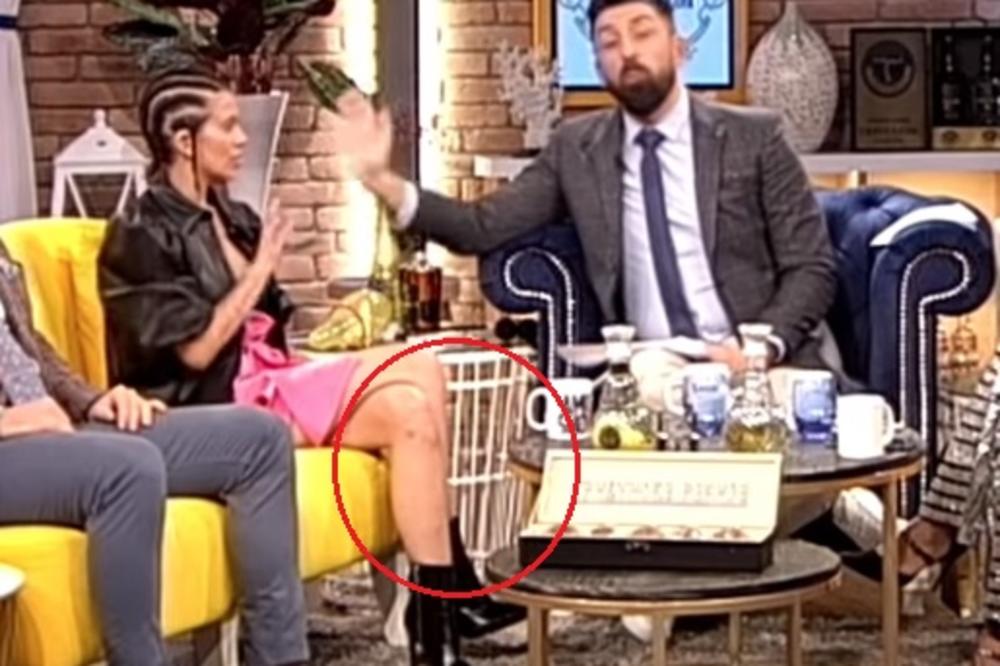 KIJA SVA U MODRICAMA DOŠLA U EMISIJU: 6 dana posle INCIDENTA sa Slobom, a rane su još uvek VIDLJIVE! (FOTO)