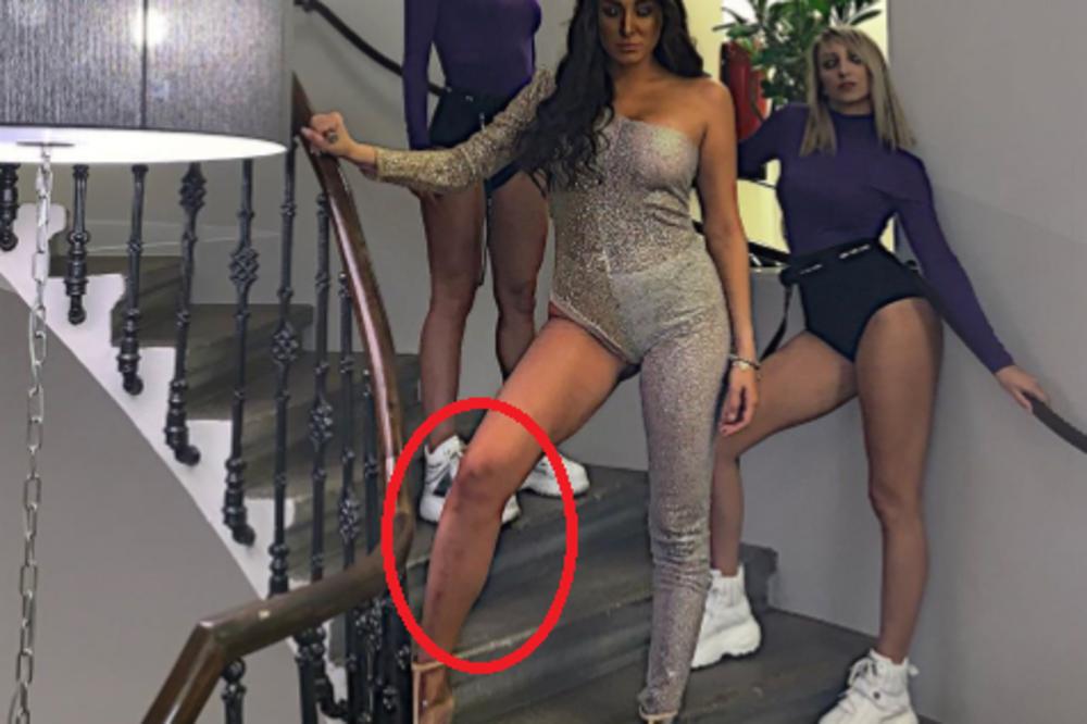 SVI HVALE LUNU ĐOGANI ZBOG NOVOG IZGLEDA: MALA TI GORIŠ! Niko nije primetio da su joj NOGE U KATASTROFALNOM IZDANJU