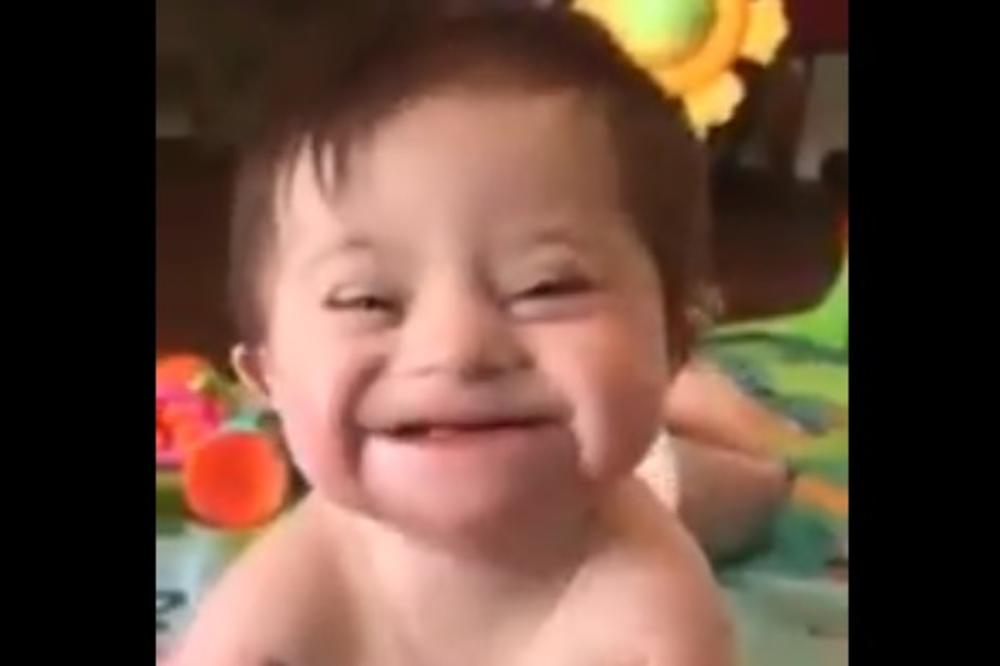 BRAČNI PAR USVOJIO JE BEBU SA DAUNOVIM SINDROMOM: Reakcija DETETA na svoju NOVU MAJKU će vas DOVESTI DO SUZA