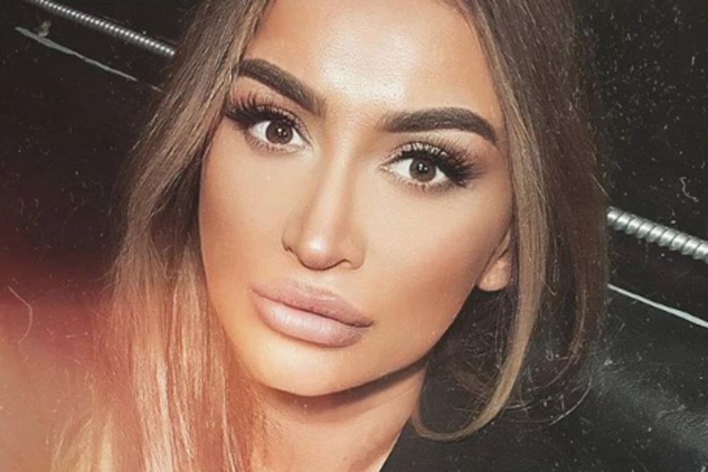 JEL OVO EMINA JAHOVIĆ ILI ANDREANA ČEKIĆ? Pevačica se TOLIKO IZOPERISALA da više niko nije siguran ko je ona!